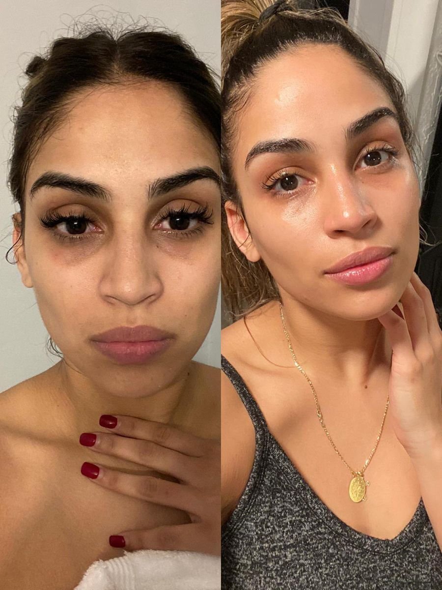 Antes y después
